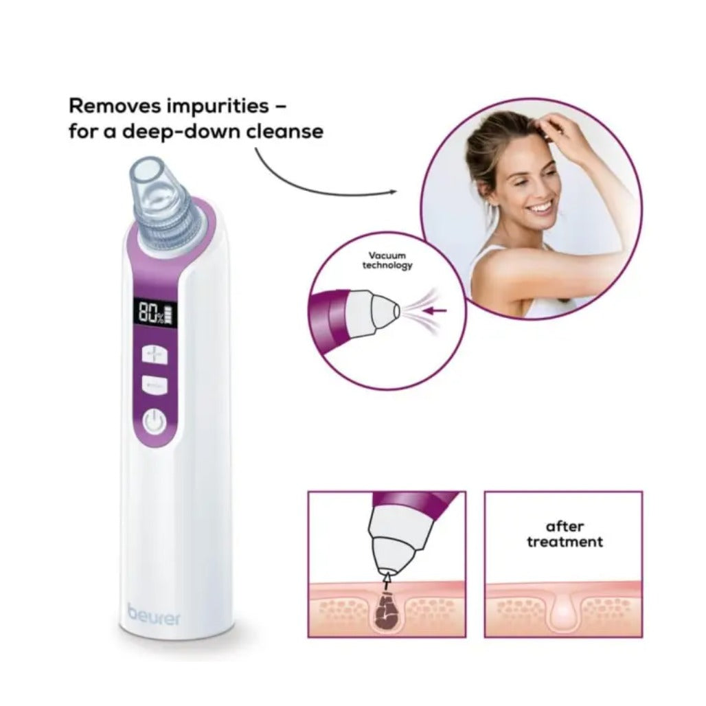 A Photo Of Beurer FC 41 Power deep pore cleanser