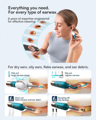 A Photo Of Bebird Earsight Ultra - 2K HD Ear Wax Removal Tool Camera