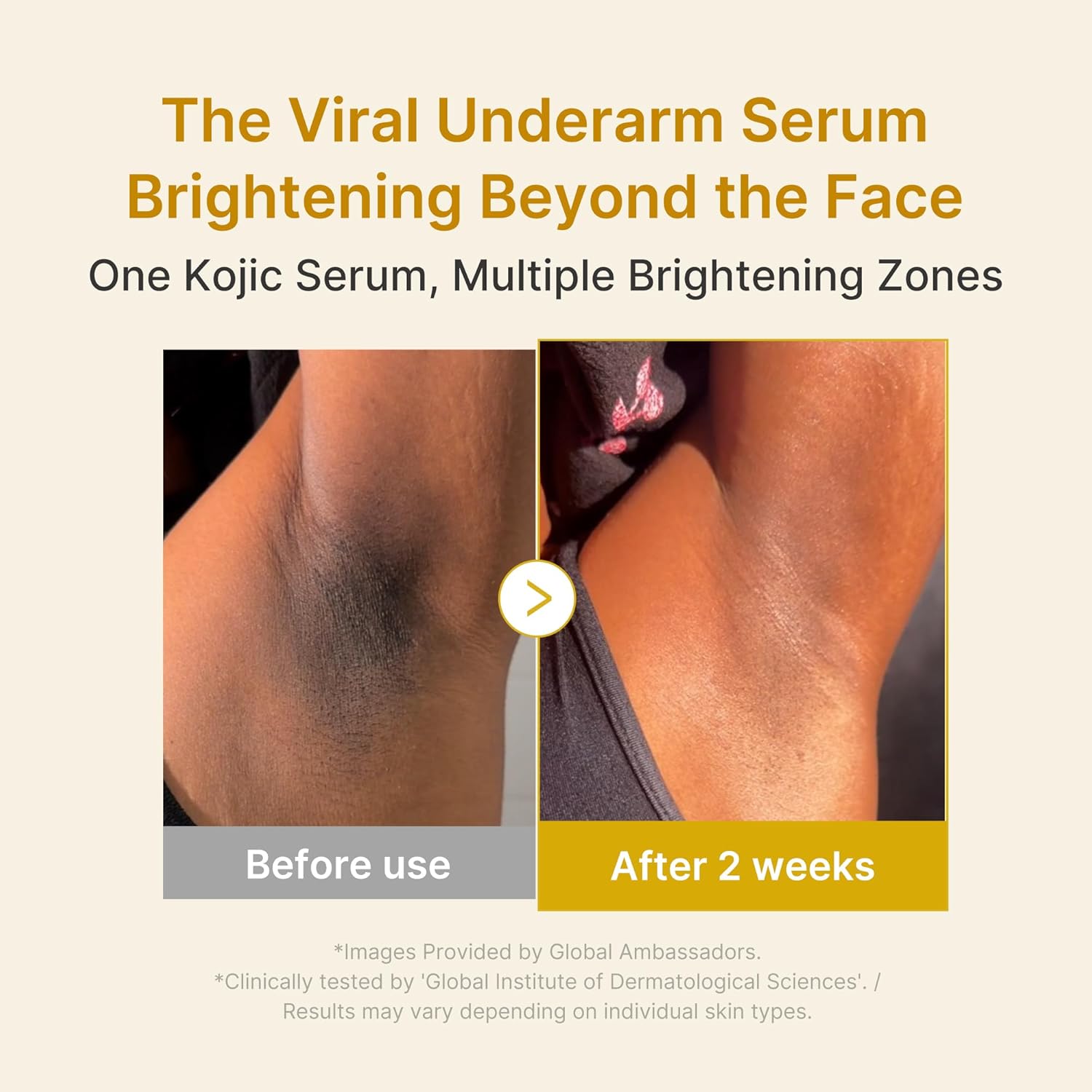 A Photo Of Medicube Kojic Acid Turmeric Niacinamide Serum - 30ml