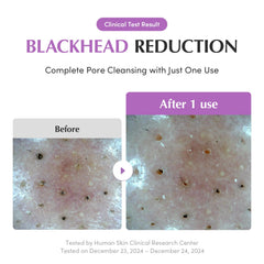 A Photo Of EQQUALBERRY Purple Rice Pore Purifying Pack Cleanser