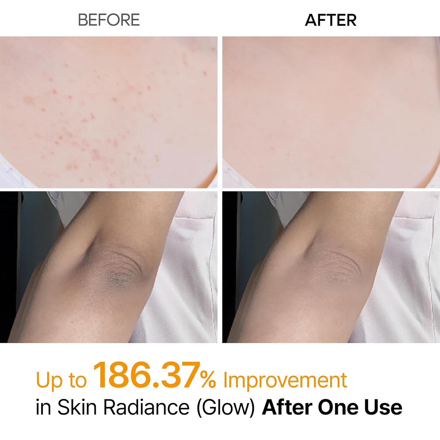 A Photo Of Dr.Melaxin Peel Shot Kojic Acid Turmeric Body Exfoliator Spray - 200ml