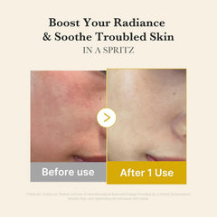A Photo Of Medicube Kojic Acid Turmeric Vita Jelly Mist Serum
