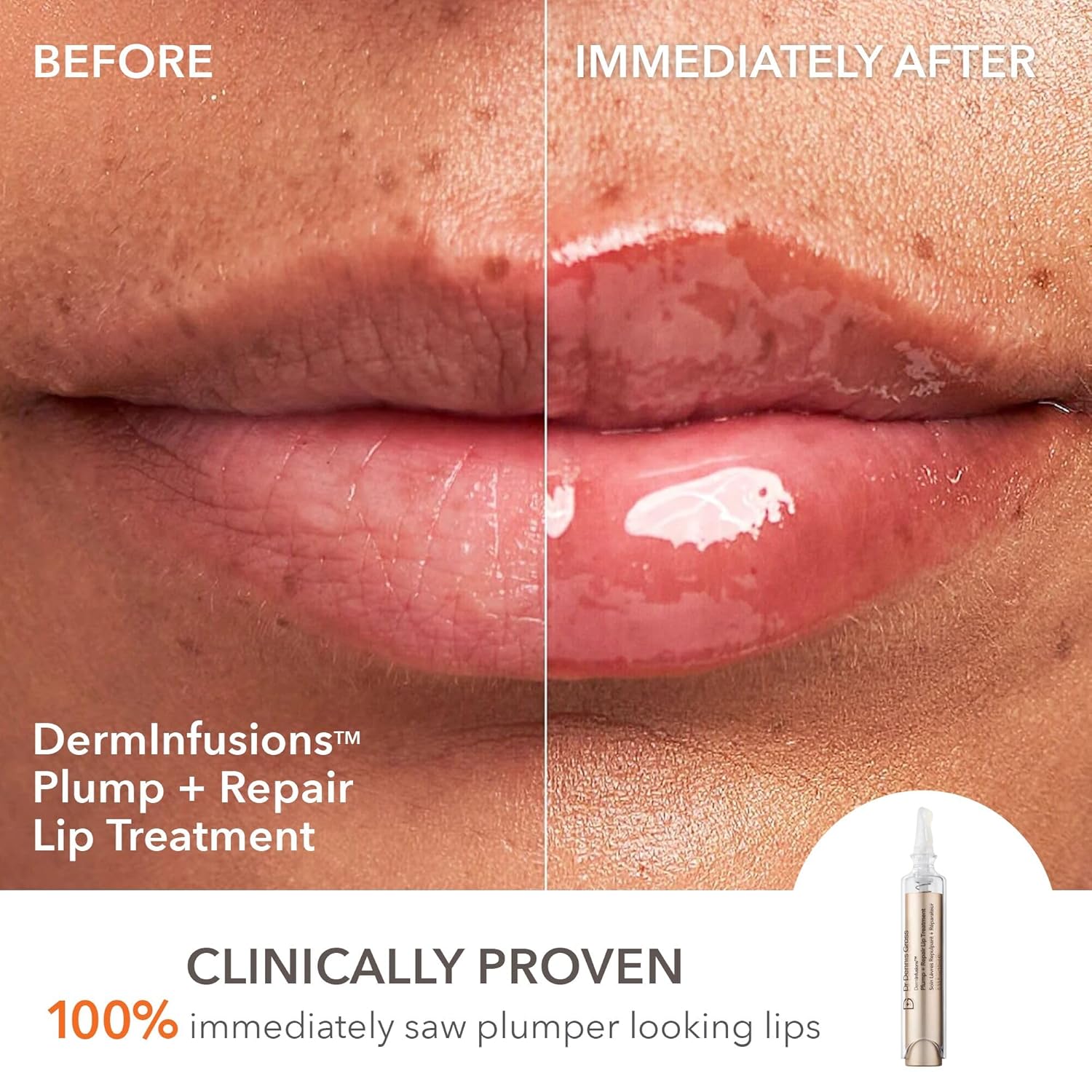 A Photo Of Dr. Dennis Gross DermInfusions 3D Plump, Fill & Repair Kit – Lip Treatment, Serum & Eye Mask