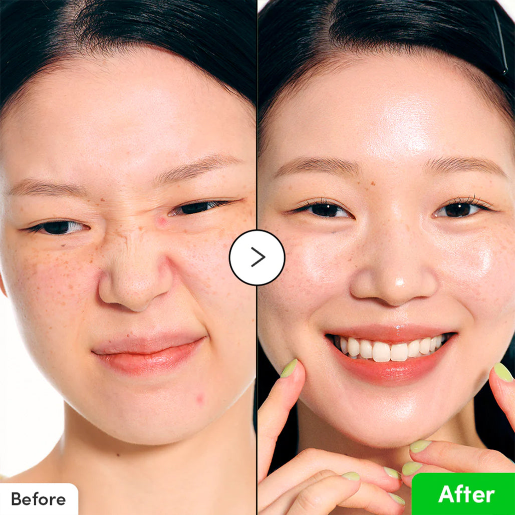 A Photo Of EQQUALBERRY Aloe PDRN Calming Serum