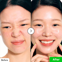 A Photo Of EQQUALBERRY Aloe PDRN Calming Serum