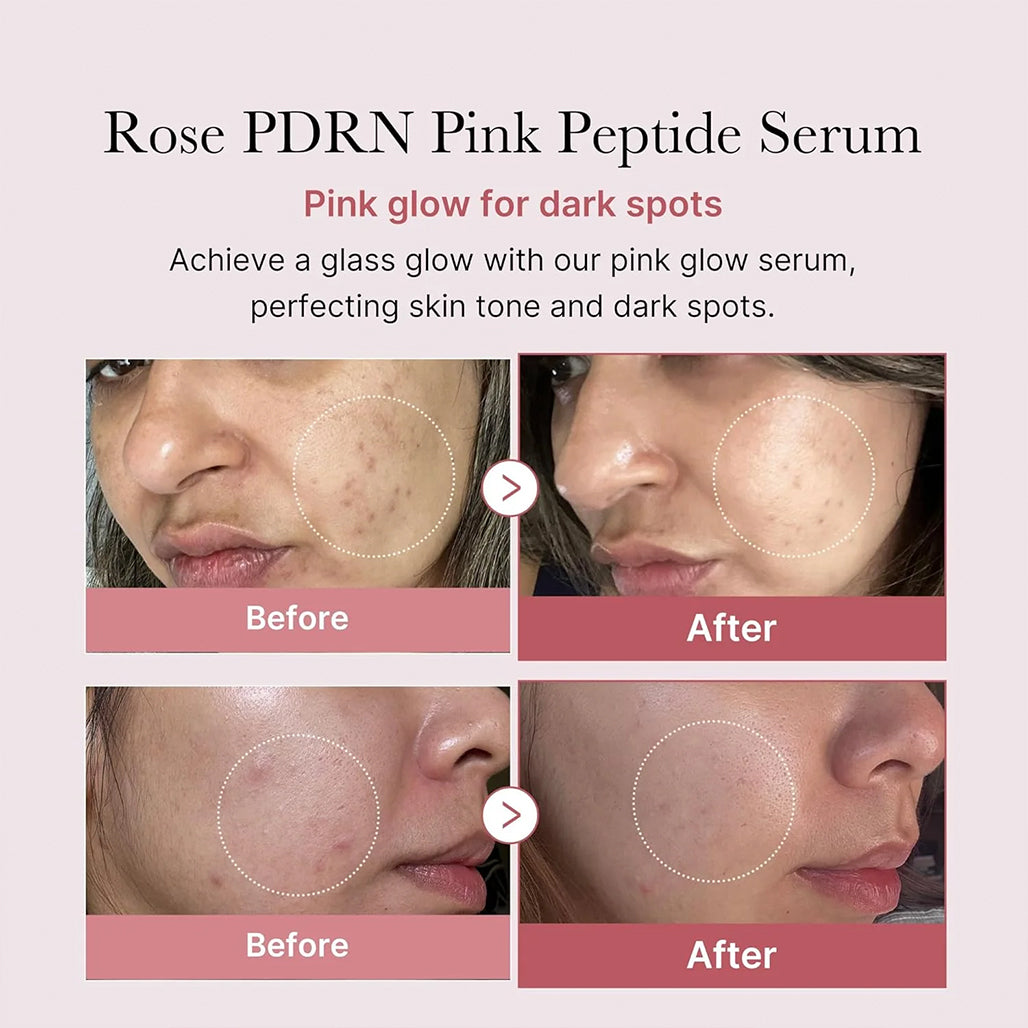 A Photo Of Medicube PDRN Pink Peptide Serum - 30ml