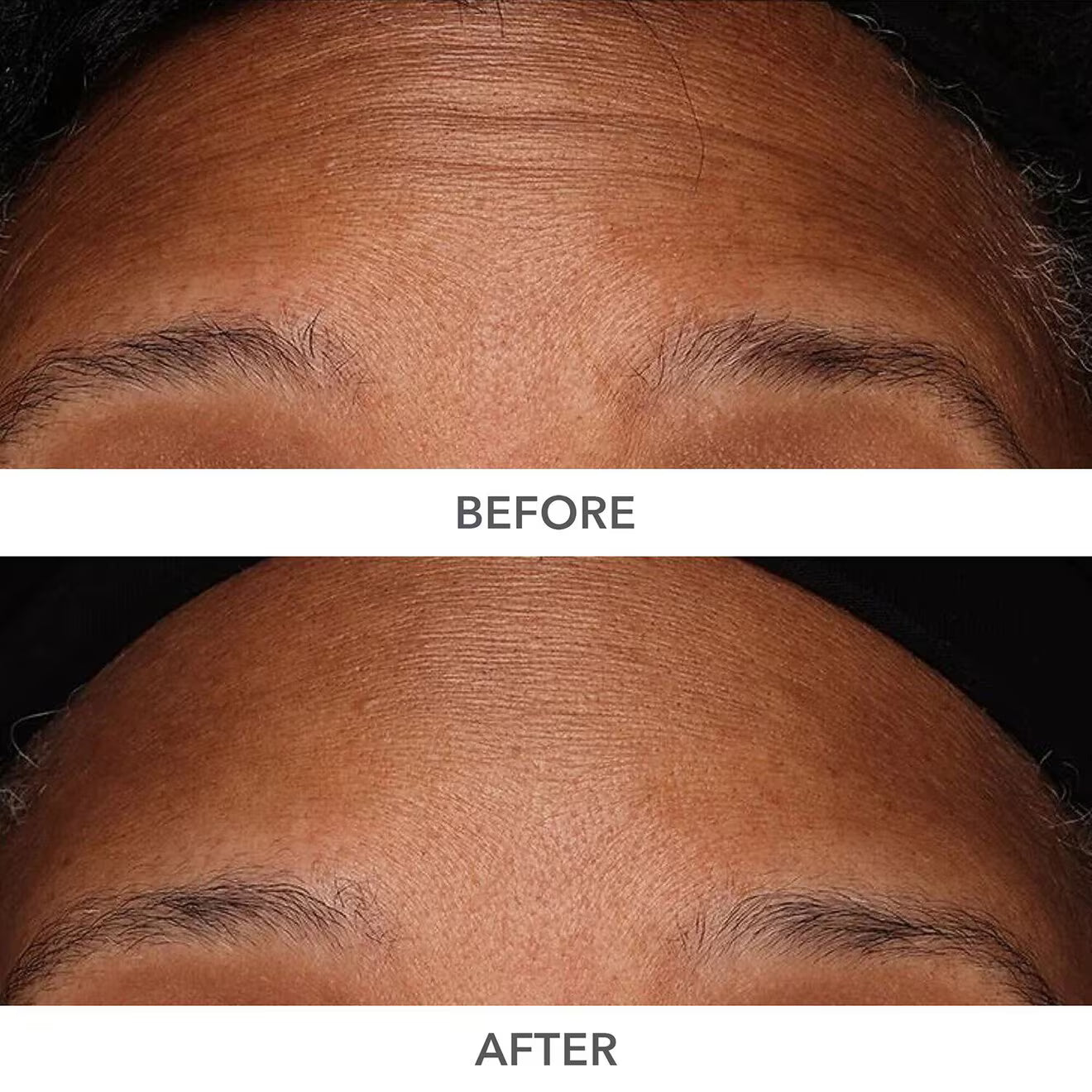 A Photo Of Dr. Dennis Gross DermInfusions 3D Plump, Fill & Repair Kit – Lip Treatment, Serum & Eye Mask