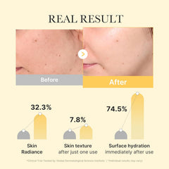 A Photo Of Medicube Kojic Acid Turmeric Gold Jelly Gel Mask