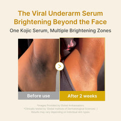 A Photo Of Medicube Kojic Acid Turmeric Niacinamide Serum - 30ml
