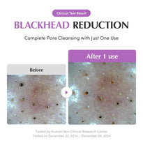 EQQUALBERRY Purple Rice Pore Purifying Pack Cleanser