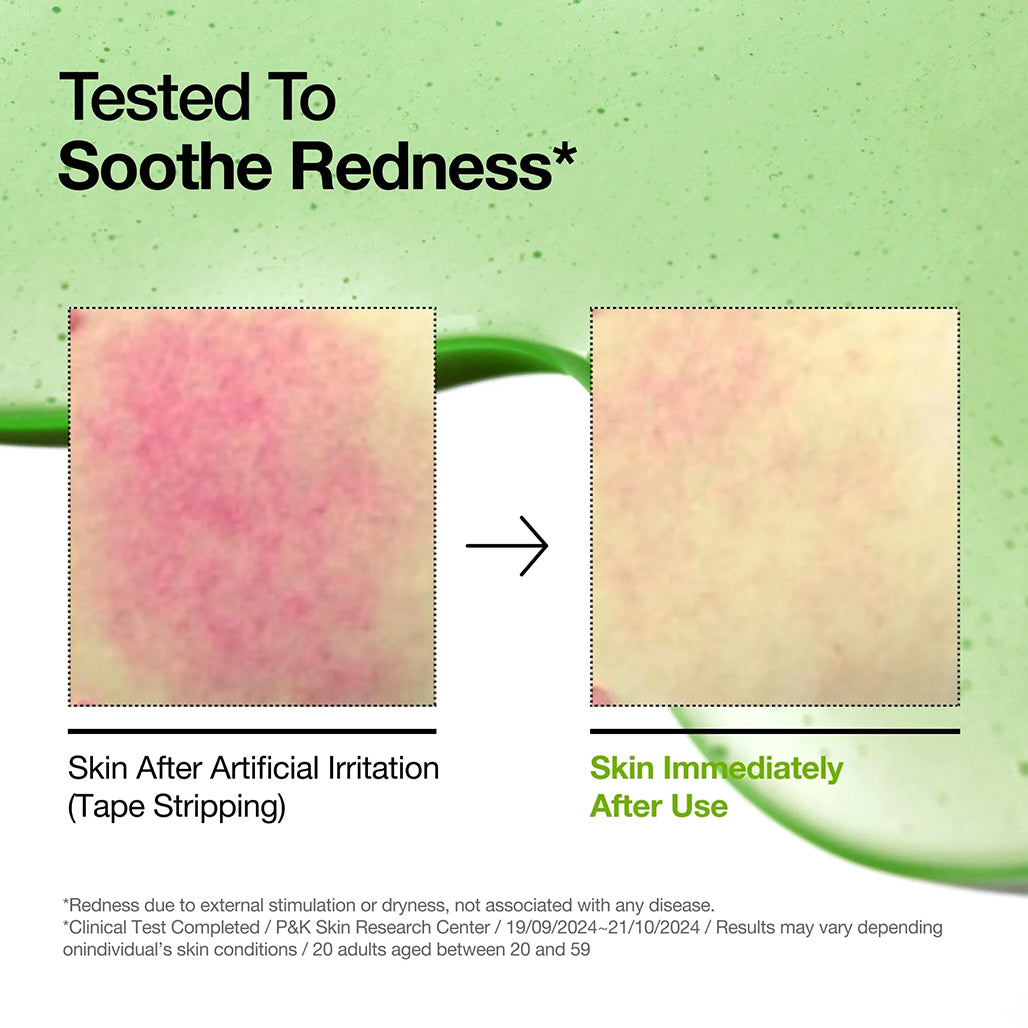 A Photo Of Anua Azelaic Acid 10+ - Hyaluron Redness Soothing Serum