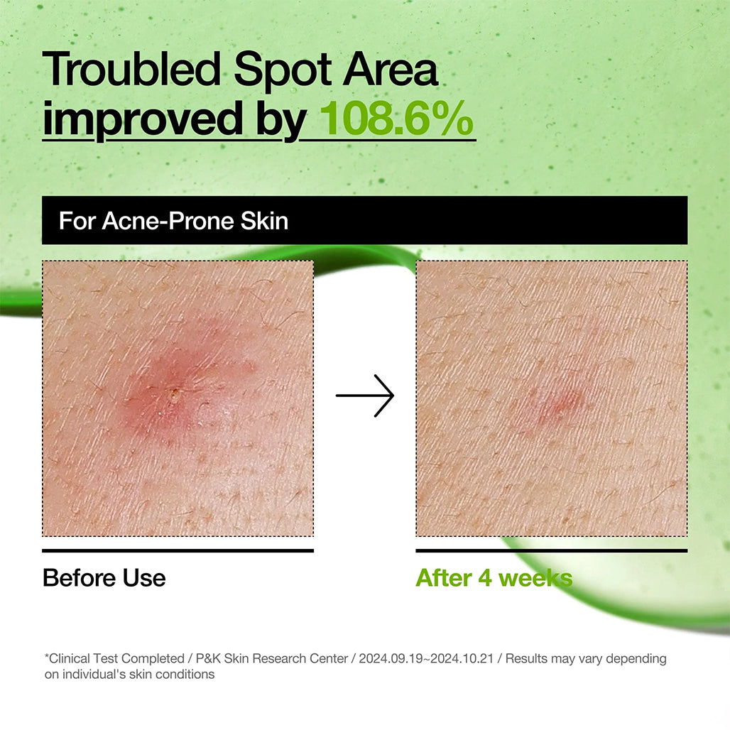 A Photo Of Anua Azelaic Acid 10+ - Hyaluron Redness Soothing Serum