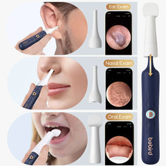 A Photo Of Bebird EarSight Plus Smart Visual Ear Cleaner - Advanced, Portable, and Precise