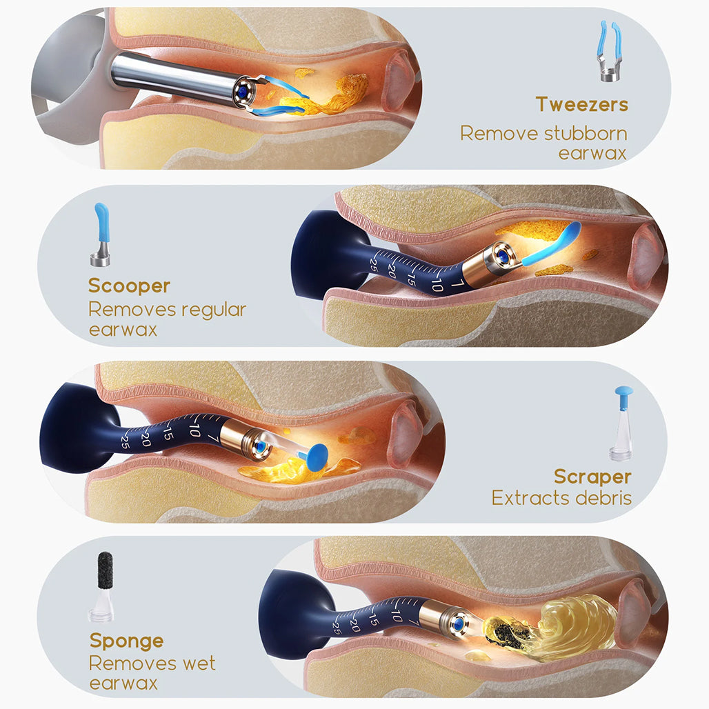 A Photo Of Bebird EarSight Plus Smart Visual Ear Cleaner - Advanced, Portable, and Precise