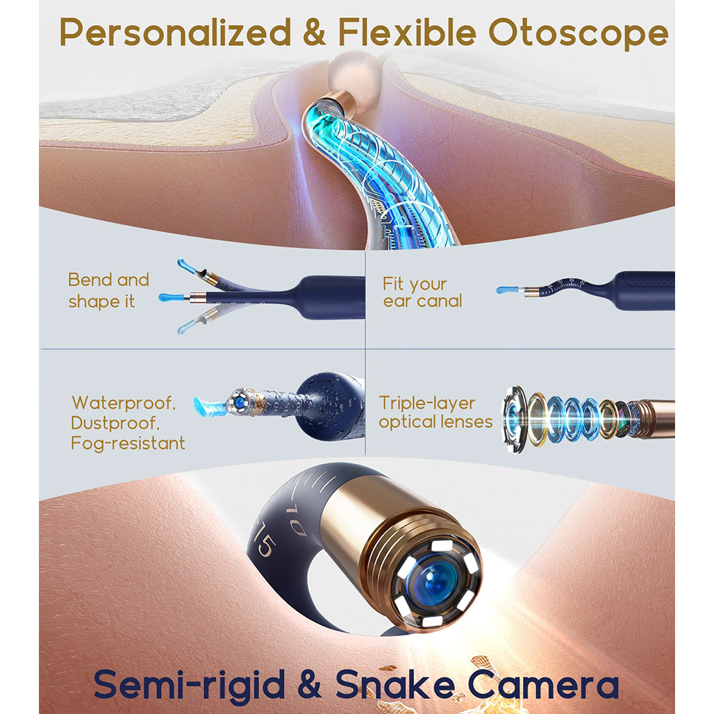 A Photo Of Bebird EarSight Plus Smart Visual Ear Cleaner - Advanced, Portable, and Precise