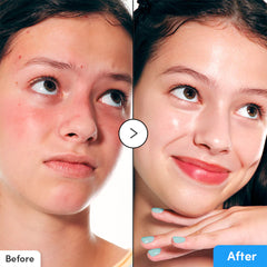 A Photo Of EQQUALBERRY Hyaltoin Flooding Serum