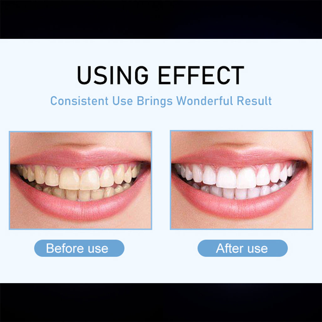 A Photo Of IVISMILE M6 Powerful Teeth Whitening Kit
