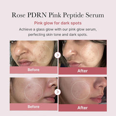 A Photo Of Medicube PDRN Pink Peptide Serum - 30ml