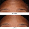 A Photo Of Dr. Dennis Gross DermInfusions 3D Plump, Fill & Repair Kit – Lip Treatment, Serum & Eye Mask
