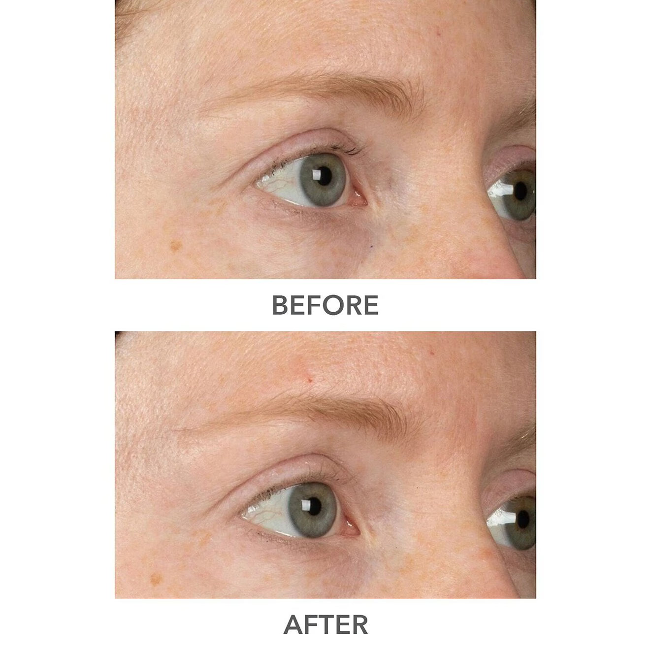 A Photo Of Dr. Dennis Gross DermInfusions 3D Plump, Fill & Repair Kit – Lip Treatment, Serum & Eye Mask
