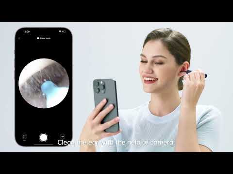A Video Of Bebird EarSight Plus Smart Visual Ear Cleaner - Advanced, Portable, and Precise